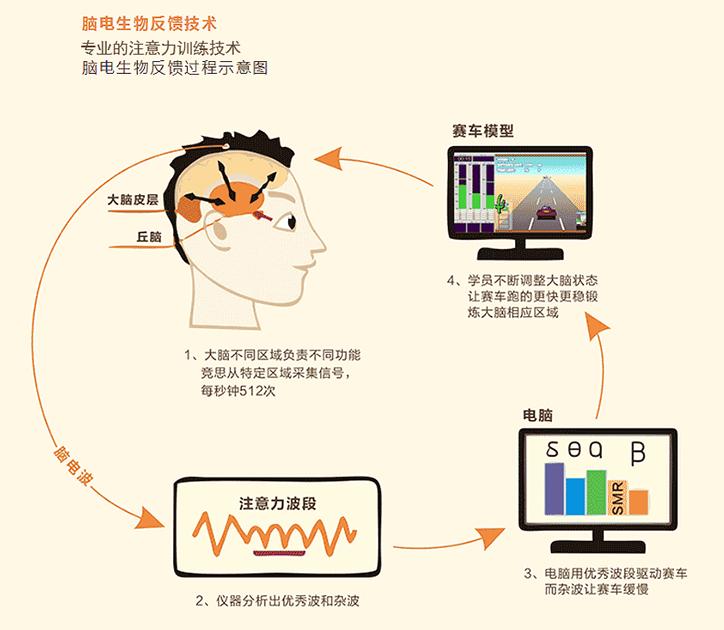 脑电生物反馈训练